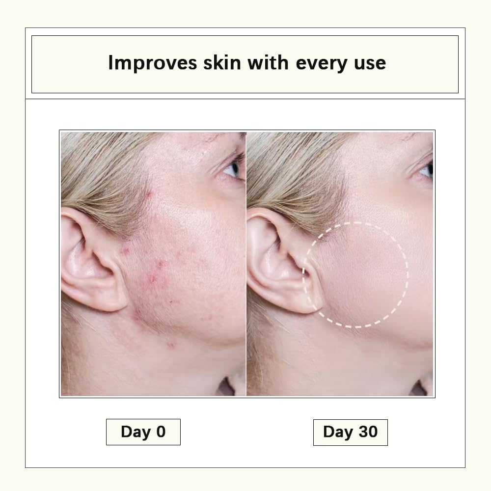 CISTTO Natural Cleansing Oil – mini portable makeup remover oil, Nourishing and Gentle for Sensitive Skin and All Skin Types, Travel-Friendly, 2ml x 20 Capsules