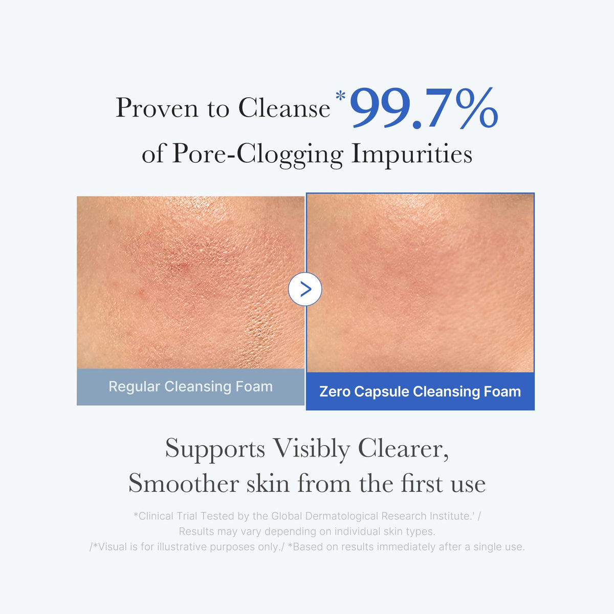 medicube Double Cleansing - Zero Pore Cleansing Oil & Zero Capsule Cleanser