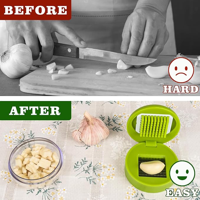 Garlic Press Stainless Steel, Garlic Mincer Tool with Storage Container, Garlic Chopper with Peeler Skin and Cleaning Brush