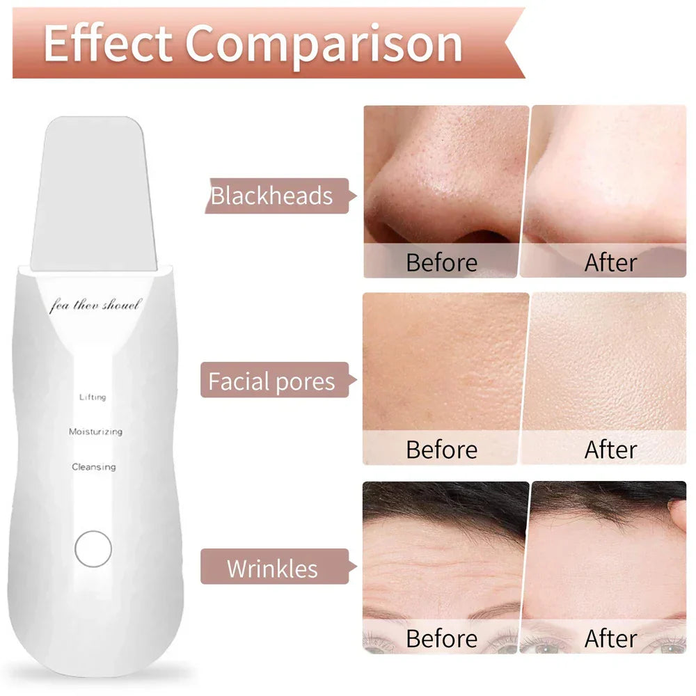 Ultrasonic Skin Scrubber Facial Spatula