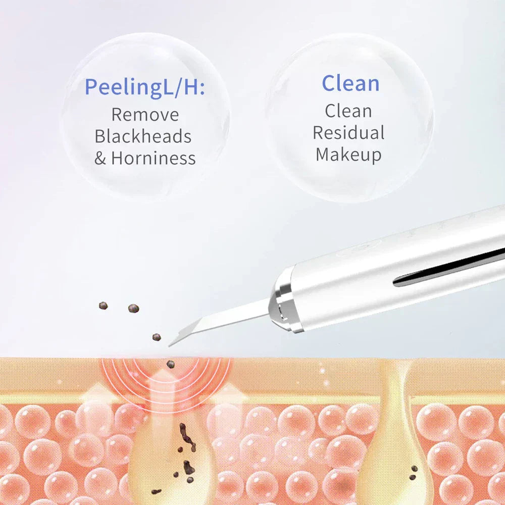 Ultrasonic Skin Scrubber Facial Spatula