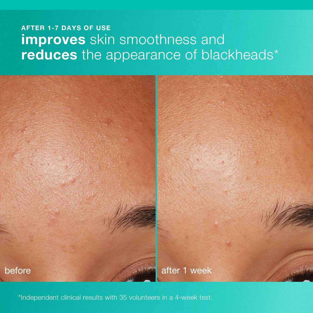 Dermalogica Clear and Brighten Kit, Travel Size