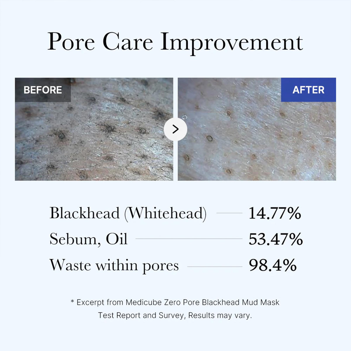 medicube Zero Pore Blackhead Mud Mask - Pore Cleansing & Gentle Exfoliating