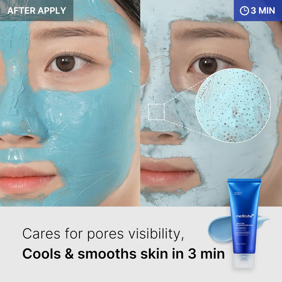 medicube Zero Pore Blackhead Mud Mask - Pore Cleansing & Gentle Exfoliating