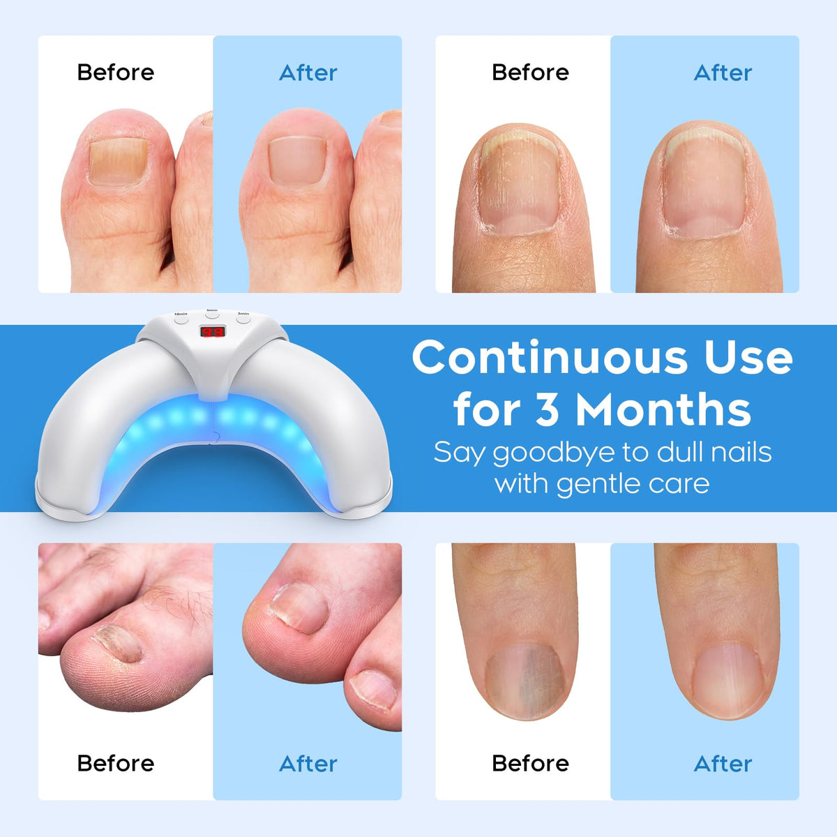 Nail Care Light for Dull, Thick Fingernails & Toenails, Plug-in White
