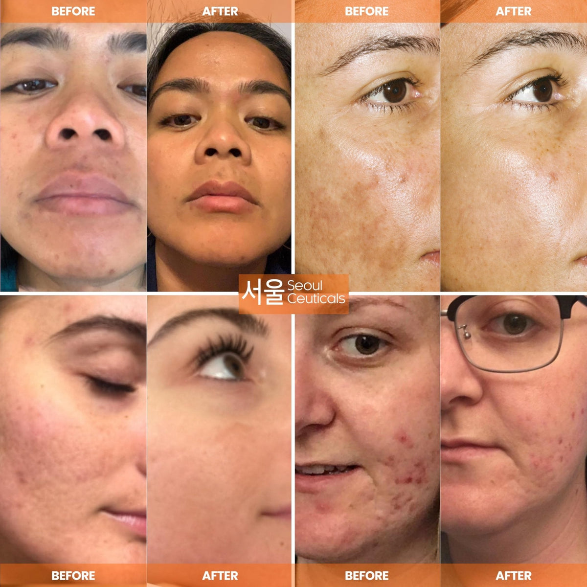SeoulCeuticals Korean Skin Care 20% Vitamin C Serum for Face + CE Ferulic